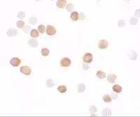 Anti-KREMEN2 antibody used in Immunocytochemistry/ Immunofluorescence (ICC/IF). GTX31529