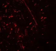 Anti-DDX41 antibody used in IHC (Paraffin sections) (IHC-P). GTX31539