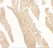 Anti-IL1F5 antibody used in IHC (Paraffin sections) (IHC-P). GTX31556