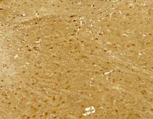 Anti-Neuroligin 2 antibody used in IHC (Paraffin sections) (IHC-P). GTX31597