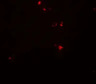 Anti-DTX4 antibody used in IHC (Paraffin sections) (IHC-P). GTX31606