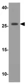 Anti-VTI1A antibody used in Western Blot (WB). GTX31627
