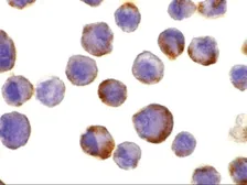 Anti-ADAM17 antibody used in Immunocytochemistry/ Immunofluorescence (ICC/IF). GTX31632