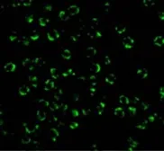 Anti-RIP2 antibody used in Immunocytochemistry/ Immunofluorescence (ICC/IF). GTX31647