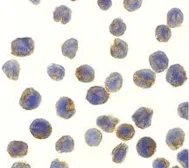 Anti-NAK / TBK1 antibody used in Immunocytochemistry/ Immunofluorescence (ICC/IF). GTX31658