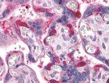 Anti-RIP antibody used in IHC (Paraffin sections) (IHC-P). GTX31684