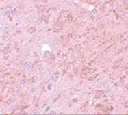 Anti-PIASy antibody used in IHC (Paraffin sections) (IHC-P). GTX31802