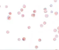 Anti-KPNA4 antibody used in Immunocytochemistry/ Immunofluorescence (ICC/IF). GTX31813