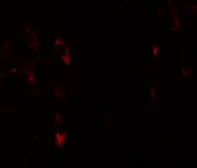 Anti-LRRTM1 antibody used in IHC (Paraffin sections) (IHC-P). GTX31823