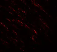 Anti-B-Raf antibody used in IHC (Paraffin sections) (IHC-P). GTX31881