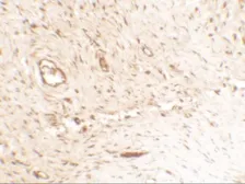 Anti-Osteopontin antibody used in IHC (Paraffin sections) (IHC-P). GTX31886