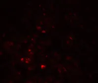 Anti-LRRC26 antibody used in IHC (Paraffin sections) (IHC-P). GTX31897