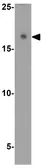 Anti-LC3A antibody used in Western Blot (WB). GTX31898