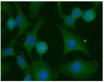 Anti-Ras antibody [AT2F8] used in Immunocytochemistry/ Immunofluorescence (ICC/IF). GTX31957