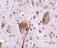 Anti-SPG11 antibody used in IHC (Paraffin sections) (IHC-P). GTX31970