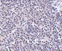 Anti-ARL15 antibody used in IHC (Paraffin sections) (IHC-P). GTX31973