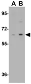Anti-IRF2BP2 antibody used in Western Blot (WB). GTX32054
