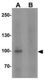 Anti-STOX1 antibody used in Western Blot (WB). GTX32076