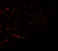 Anti-VPS13B antibody used in IHC (Paraffin sections) (IHC-P). GTX32078