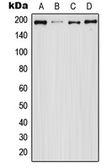 Anti-EGFR (phospho Ser1047) antibody used in Western Blot (WB). GTX32174