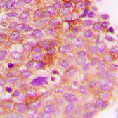 Anti-IRS1 (phospho Ser307) antibody used in IHC (Paraffin sections) (IHC-P). GTX32202