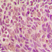 Anti-Smad1 (phospho Ser187) antibody used in IHC (Paraffin sections) (IHC-P). GTX32213