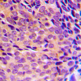 Anti-NFkB p105/p50 (phospho Ser337) antibody used in IHC (Paraffin sections) (IHC-P). GTX32223