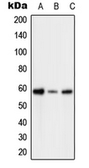 Anti-PFKFB2 (phospho Ser483) antibody used in Western Blot (WB). GTX32234