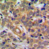 Anti-NFkB p65 (phospho Ser311) antibody used in IHC (Paraffin sections) (IHC-P). GTX32255