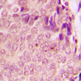Anti-STAT3 (phospho Ser727) antibody used in IHC (Paraffin sections) (IHC-P). GTX32267