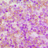 Anti-CDC25A (phospho Ser76) antibody used in IHC (Paraffin sections) (IHC-P). GTX32374