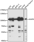 Anti-AKAP8 antibody used in Western Blot (WB). GTX32429