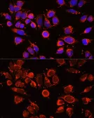 Anti-alpha 2 Macroglobulin antibody used in Immunocytochemistry/ Immunofluorescence (ICC/IF). GTX32434