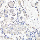 Anti-BAP1 antibody used in IHC (Paraffin sections) (IHC-P). GTX32464