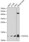 Anti-COX7A2L antibody used in Western Blot (WB). GTX32535