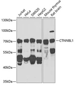 Anti-CTNNBL1 antibody used in Western Blot (WB). GTX32543