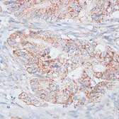 Anti-Desmoplakin antibody used in IHC (Paraffin sections) (IHC-P). GTX32557