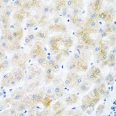 Anti-DHODH antibody used in IHC (Paraffin sections) (IHC-P). GTX32560