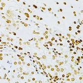 Anti-DKC1 antibody used in IHC (Paraffin sections) (IHC-P). GTX32562
