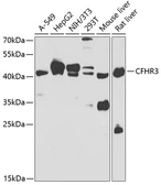 Anti-FHR3 antibody used in Western Blot (WB). GTX32603