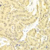 Anti-FLIP antibody used in IHC (Paraffin sections) (IHC-P). GTX32608