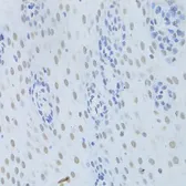 Anti-hnRNP K antibody used in IHC (Paraffin sections) (IHC-P). GTX32658