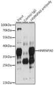 Anti-hnRNP A0 antibody used in Immunoprecipitation (IP). GTX32659