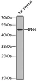 Anti-IFI44 antibody used in Western Blot (WB). GTX32667