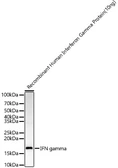 Anti-Interferon gamma antibody used in Western Blot (WB). GTX32669