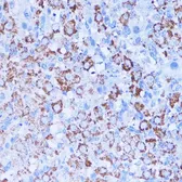 Anti-ISG15 antibody used in IHC (Paraffin sections) (IHC-P). GTX32686