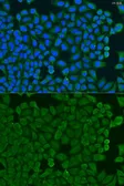 Anti-KCTD15 antibody used in Immunocytochemistry/ Immunofluorescence (ICC/IF). GTX32690