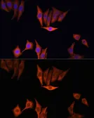 Anti-K-Ras antibody used in Immunocytochemistry/ Immunofluorescence (ICC/IF). GTX32694