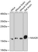 Anti-NAT5 antibody used in Western Blot (WB). GTX32736