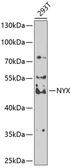 Anti-NYX antibody used in Western Blot (WB). GTX32763